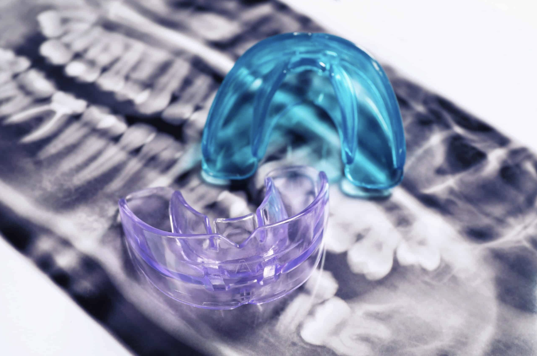 Custom mouthguard at 207 Dental in Auburn, ME