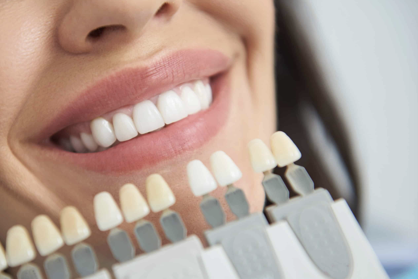 Professional teeth whitening at 207 Dental in Auburn, ME